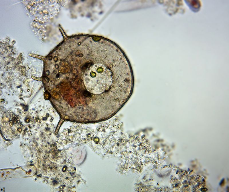 Centropyxis aculeata